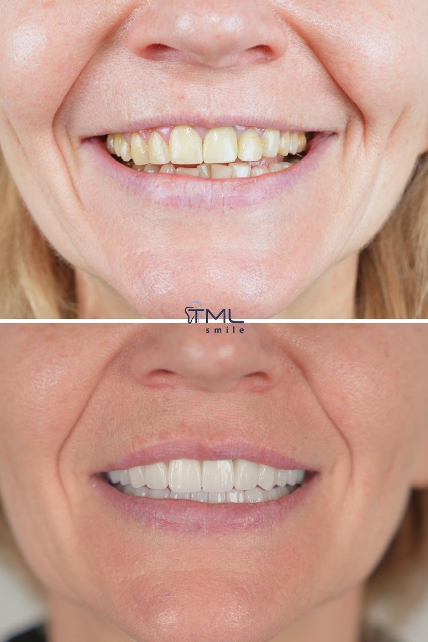 TML Smile Studio