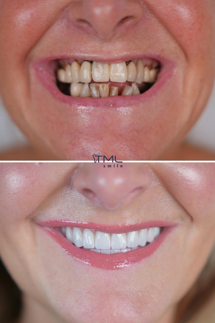 TML Smile Studio