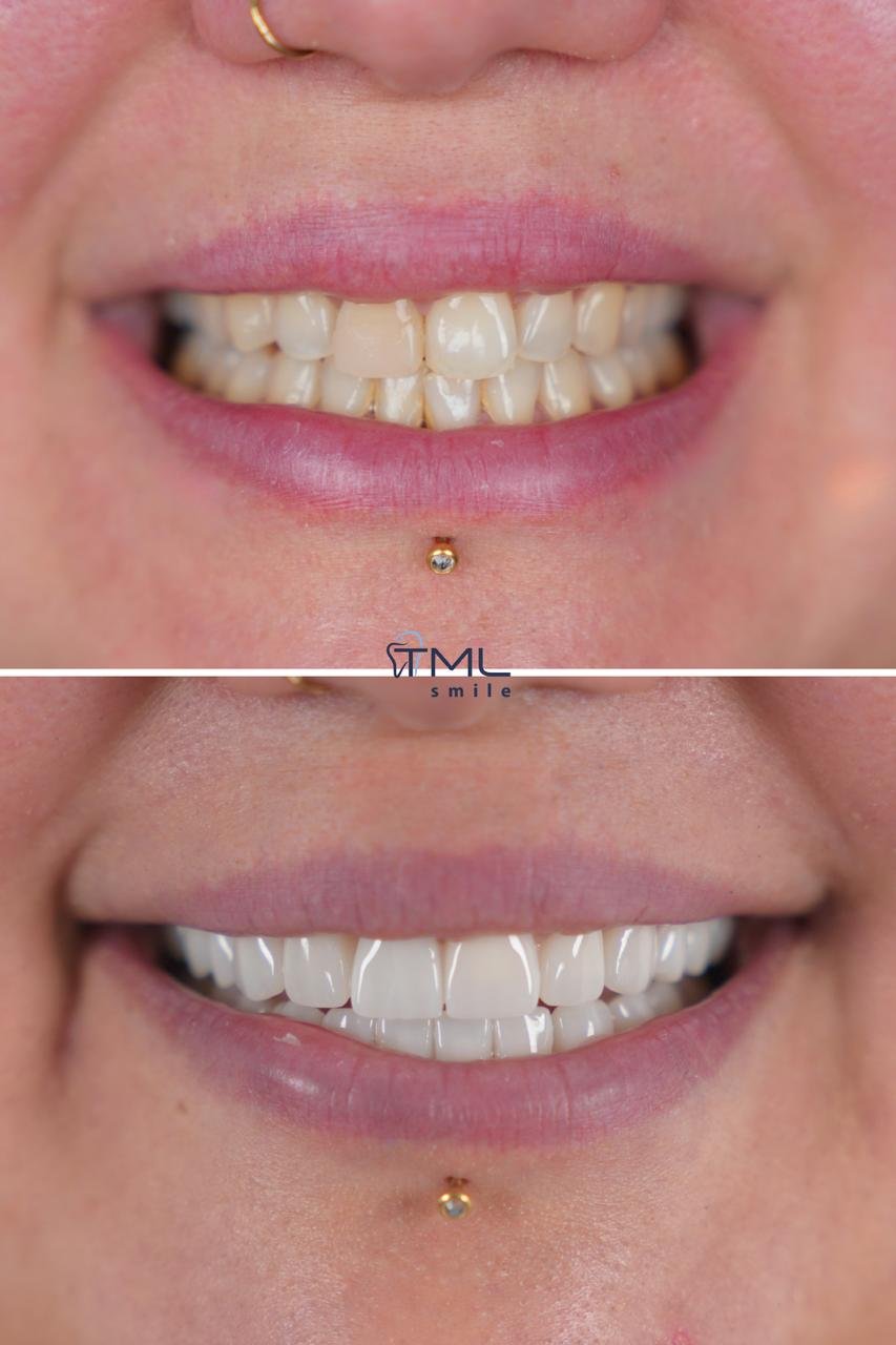 TML Smile Studio